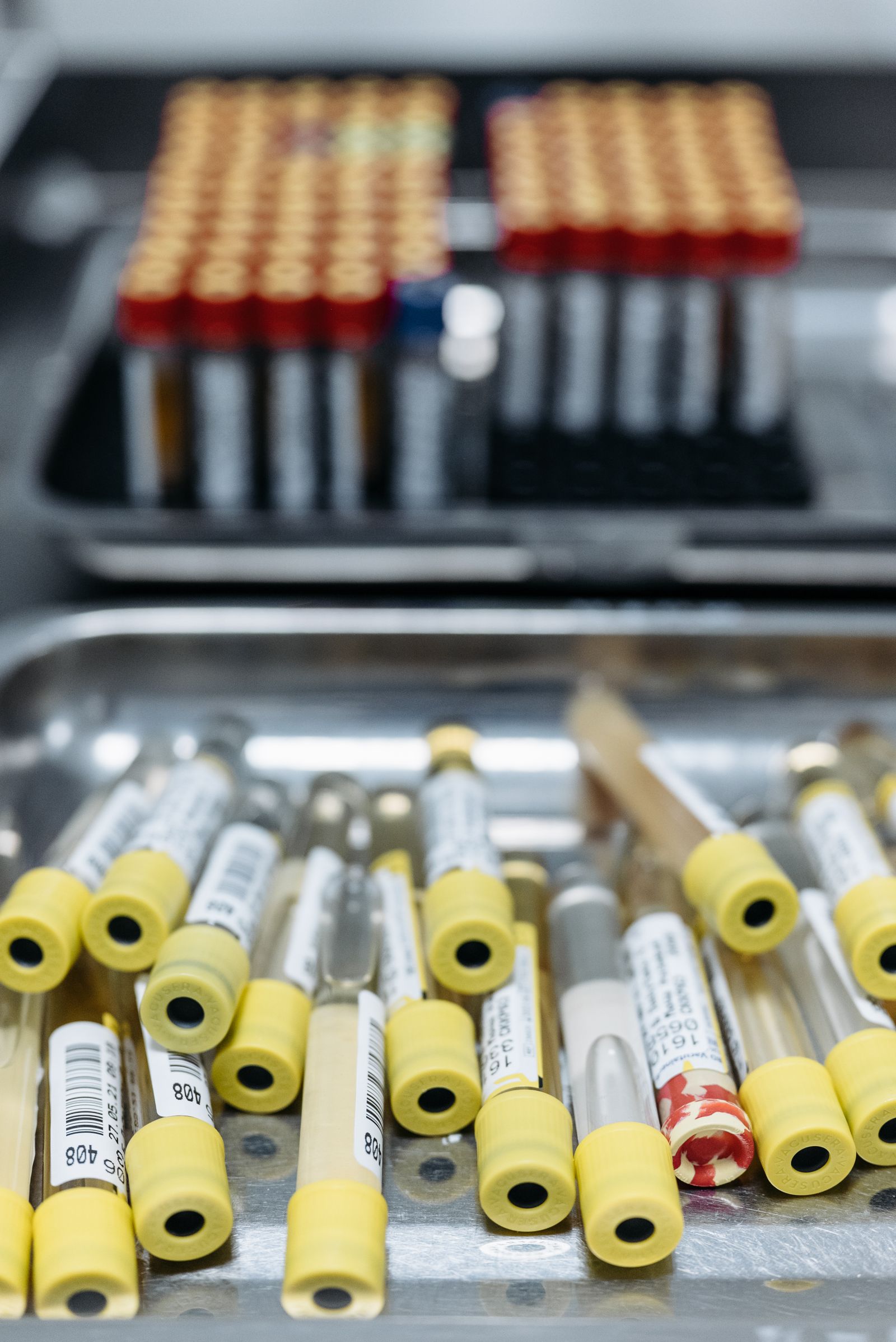 Laboratory sample tubes prepared for analysis